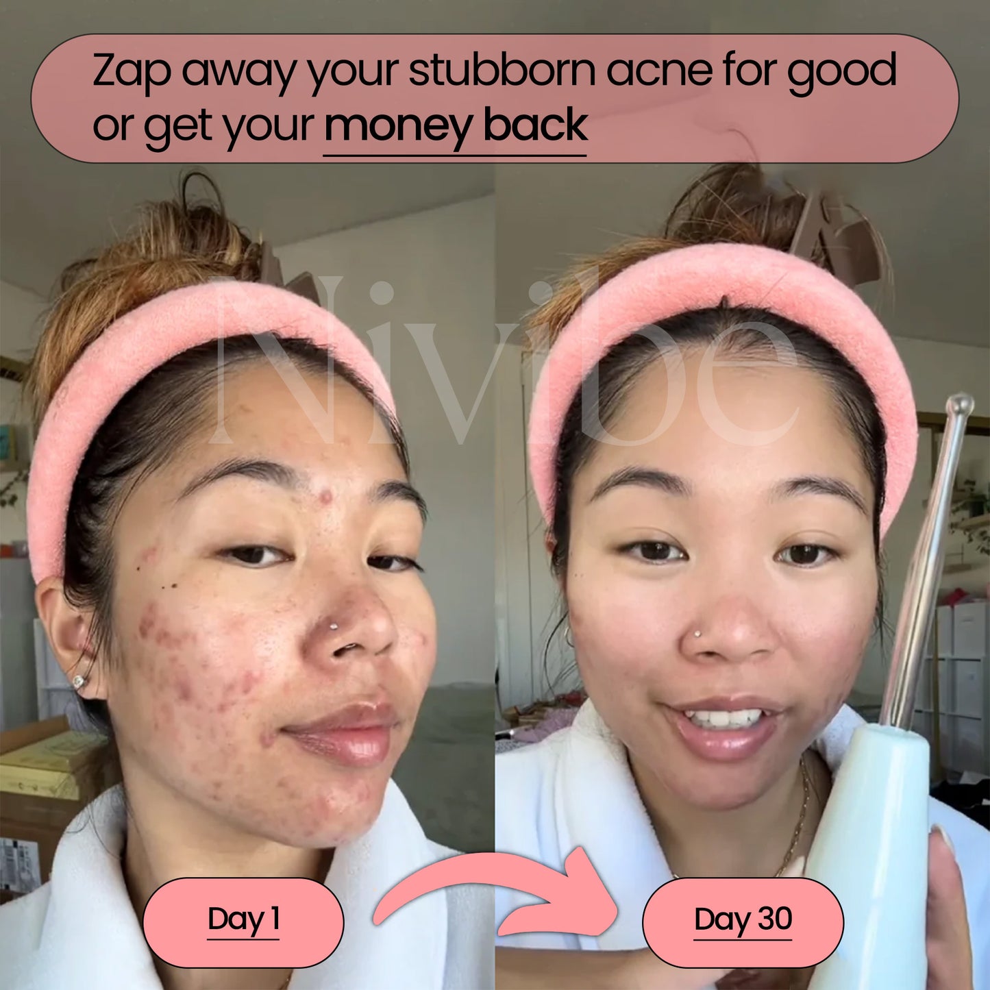 BeautyPro 2.0 - High Frequency Wand
