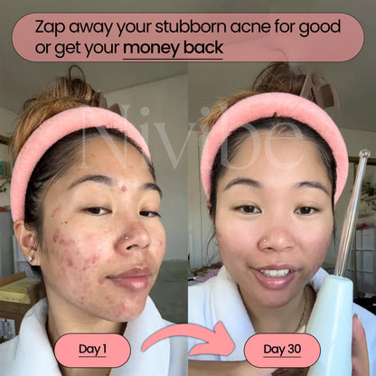 BeautyPro 2.0 - High Frequency Wand